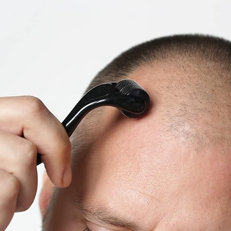 Derma Roller for Hair