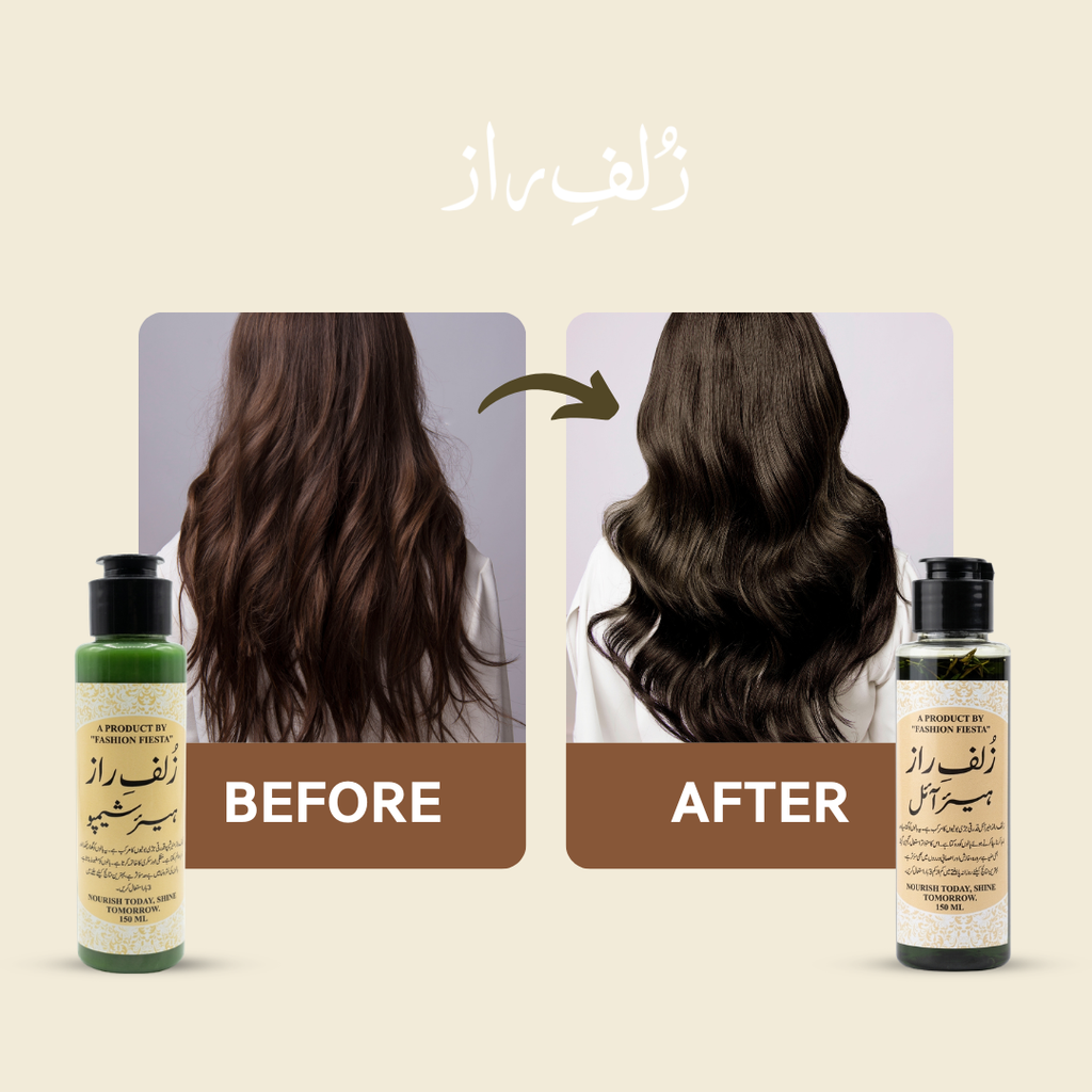 Herbal Hair Growth Oil